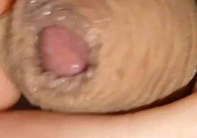 Cumshot of the Largest Phimosis Foreskin in the World.