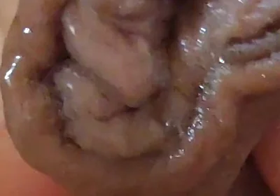 Large Foreskin and Balls in Striking Close-up.