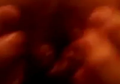 My First Anal Prolapse Video That I Shot