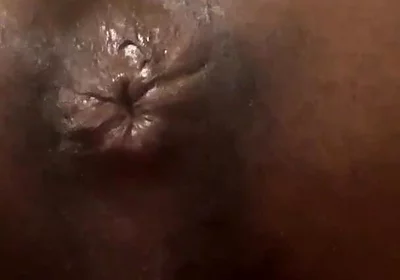 Talking About My Butt Hole