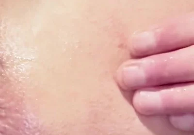 Fingering with Potato & Golf-balls