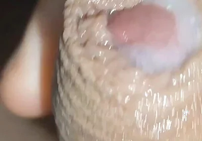 I Have the Largest Ejaculating Phimosis in the World!!