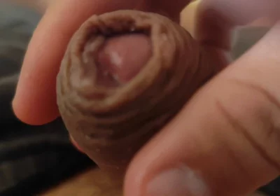 Great Phimosis Getting in the Way of the Boy's Orgasm