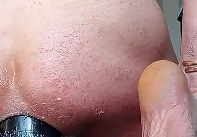 Fireworks of Sperm After a Major Dilation