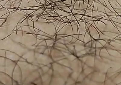 I'm Hairy Boy This My Legs and Dick