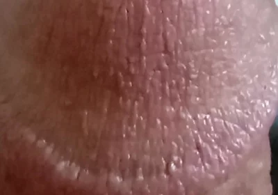 My Dick