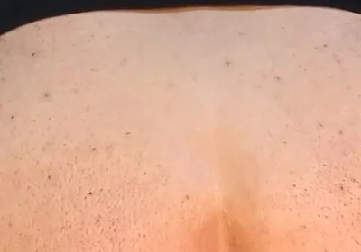 He Enjoys Sucking on His Anal Prolapse