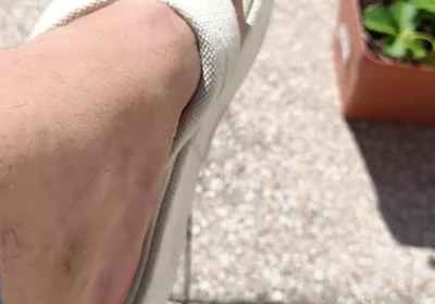 Summer Heels