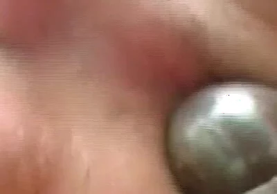 Gaping Anal Rosebud Prolapsing After Deep Stretching Session