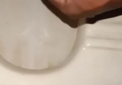 Urinating From the Penis