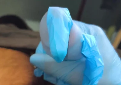 Running in a Latex Glove
