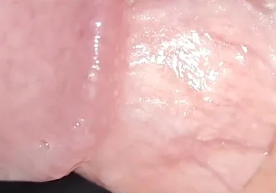 Incredible Cock, Unique of Slippery Phimosis by the Robust Body.