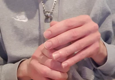 Skinny Lad Pulls Back Skin to Show Bellend