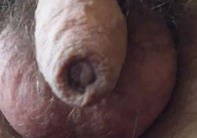 My Penis Walkabout