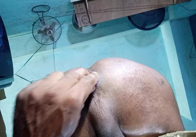 Anal sex