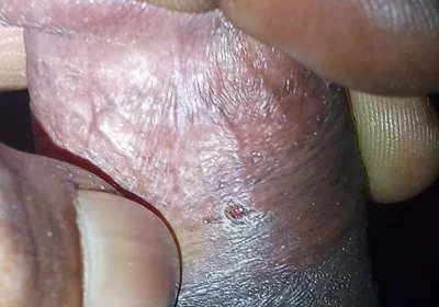 Now Videos