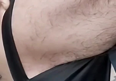 A Sperm Injection