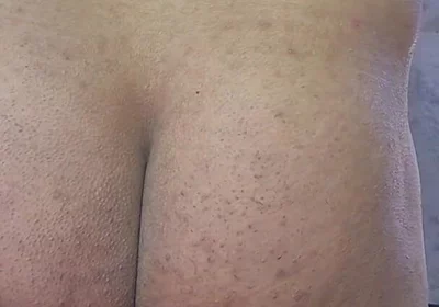 First Time Using an Inflatable Anal Ball