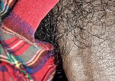 Close up on These Thick Veins