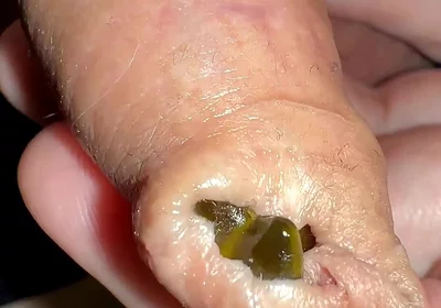 Juicy Small Cock Foreskin Games