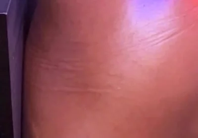 Bubble Butt