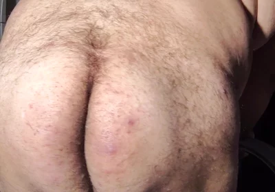 Fat Obese Butt