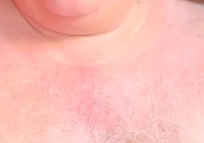Old Man with Thickest Mushroom Penis