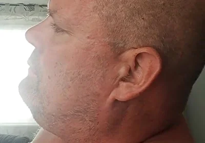 Renewed Destruction of the Bitch