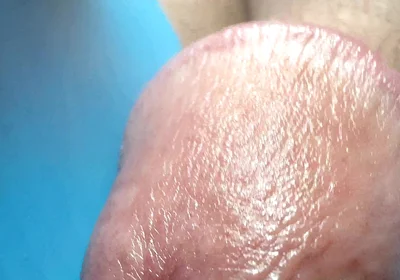 Hole Is Drilled Through