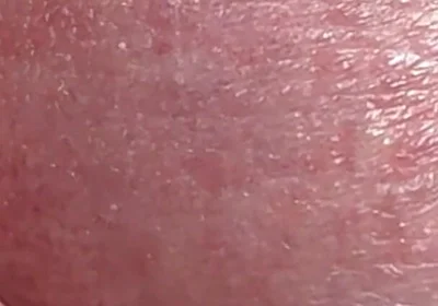 Sperm Close-up Front