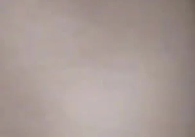 Destroying the Asshole on the Dick