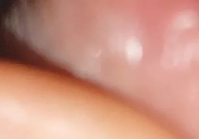 Hot Daddy in Close-up of the Inside of the Glans!