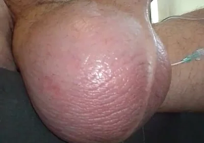 My Plump Juicy Watermelon Getting a Feeding