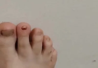 11-26-2025 Cute Little Toes