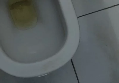 Homemade Method for Freezing the Penis