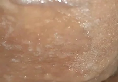 Scrotal Phimosis Results in an Extremely Hot Orgasm.